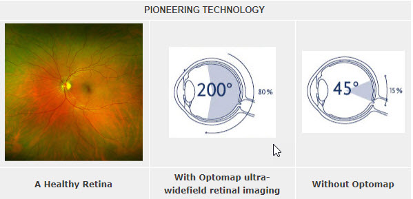 Optomap Eye Examination - Pioneering Technology - Optique - Opticians in Battersea
