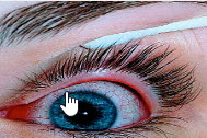 Conjunctivitis - Info from Optique, opticians in Battersea