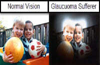 Glaucoma - Info from Optique, opticians in Battersea