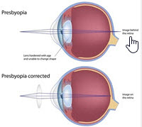 Presbyopia - Indo from Optique, opticians in Battersea